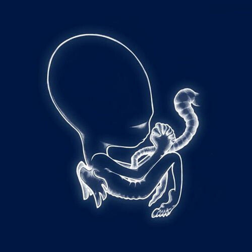 Sigur Ros – Agaetis Byrjun